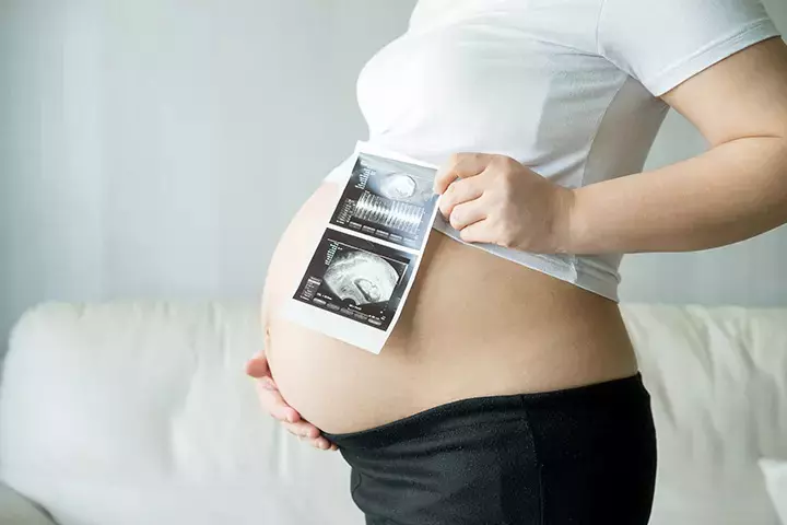 Anomaly scan is done when you're 21 weeks pregnant