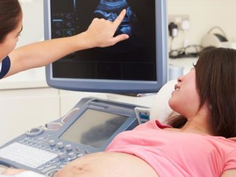 Nuchal Translucency Scan: What It Is & How It Is Done