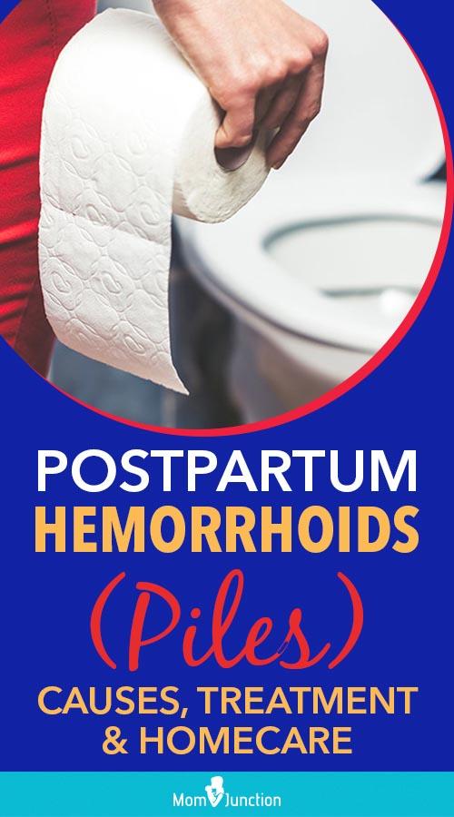 Postpartum Hemorrhoids (Piles) Causes, Treatment And Homecare