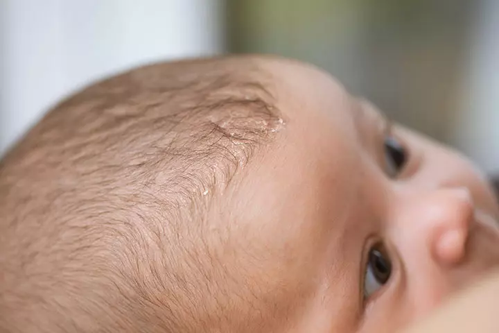 Weird Hair Pattern