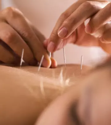 Can Acupuncture Help You Get Pregnant