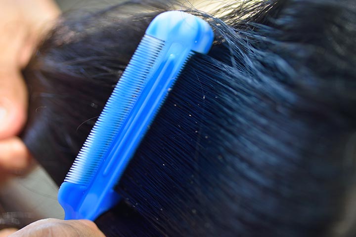 What Are The Symptoms And Signs Of Lice To Look For