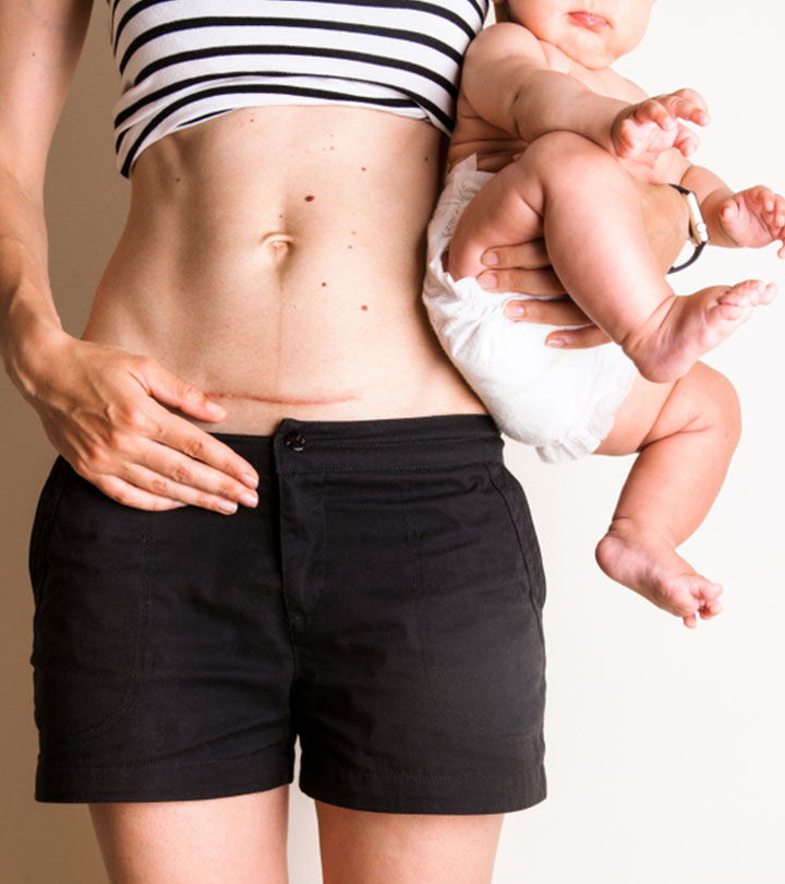 9 Moms Get Real About Their Post-Baby Body (And We Aren’t Talking About Weight)