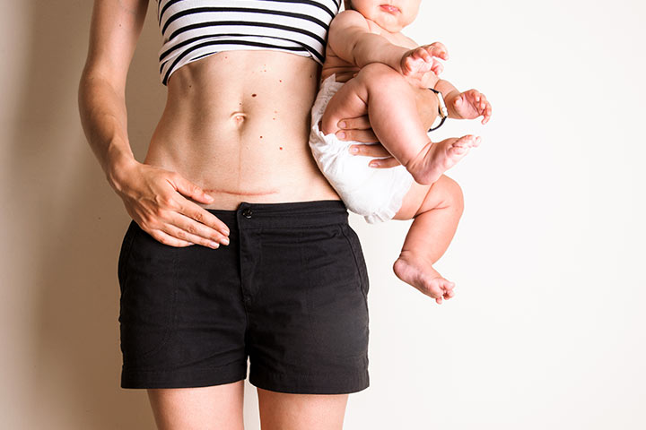 Postpartum Body