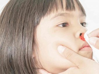बच्चों की नाक से खून (नकसीर) आना | Baccho Ki Naak Se Khoon Kyu Nikalta Hai