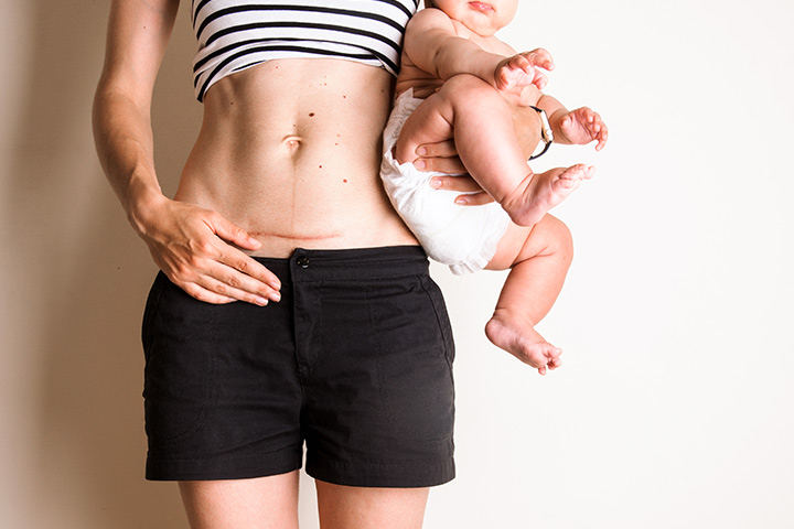 Accepting Postpartum Body The Way It Is