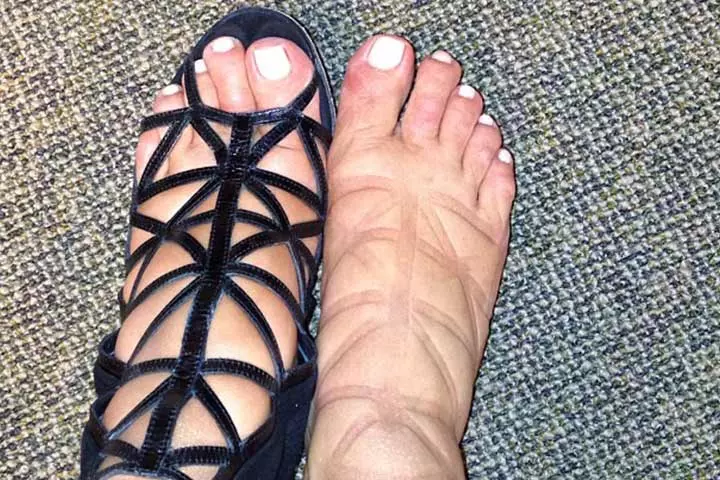 Ouch That Must Have Hurt