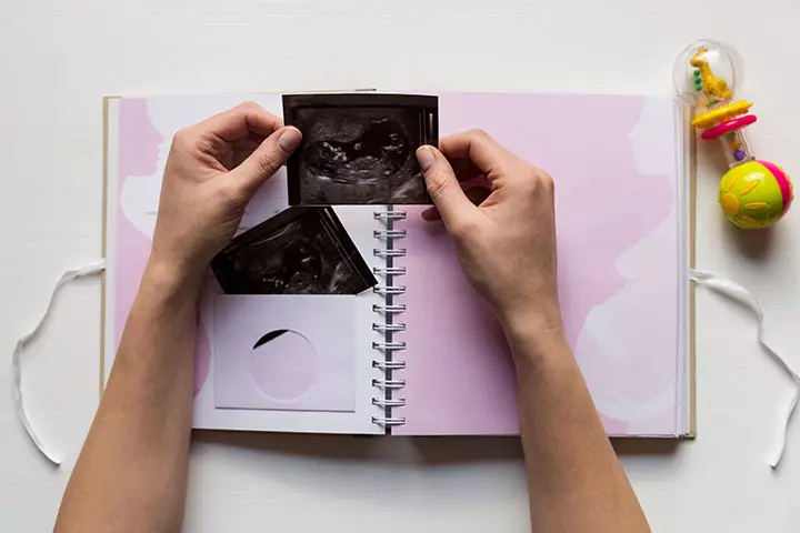 Sonogram Memory Book