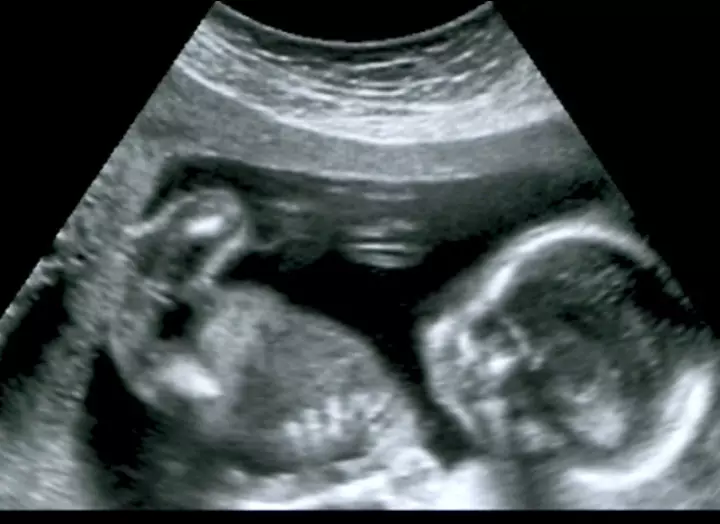 Fetal development week 16