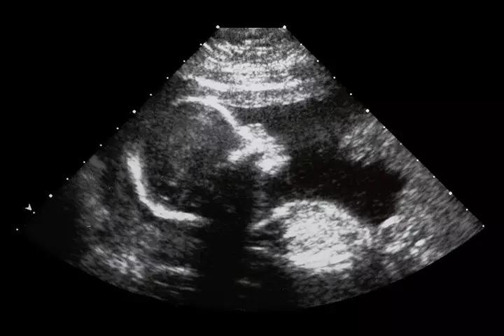 Fetal development week 17
