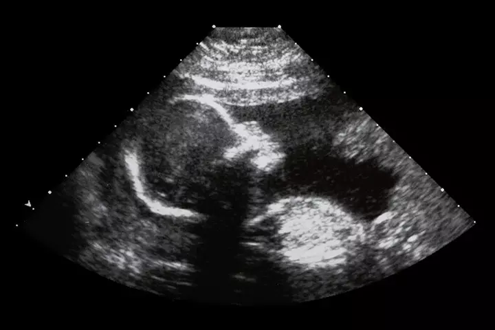 Fetal development week 17