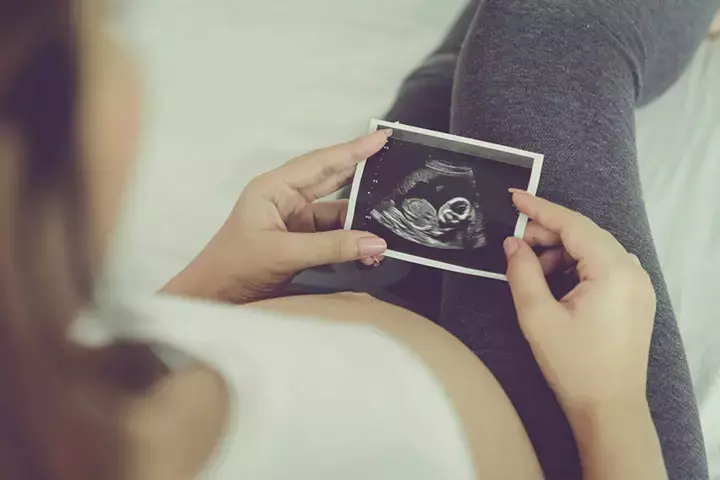 Fetal development week 18
