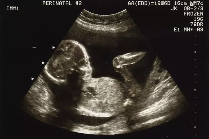 Fetal development week 19