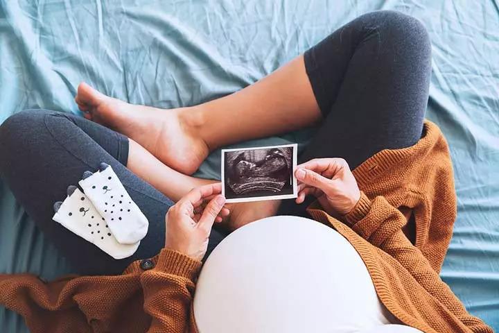 Fetal development week 23
