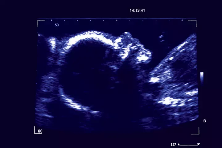 Fetal development week 26