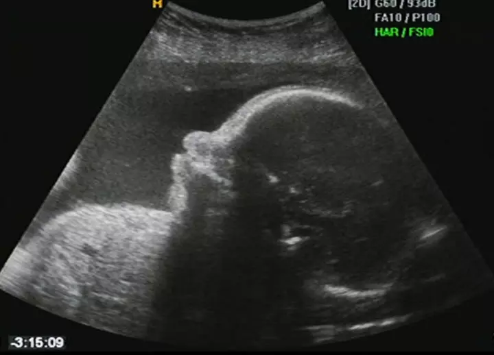 Fetal development week 27