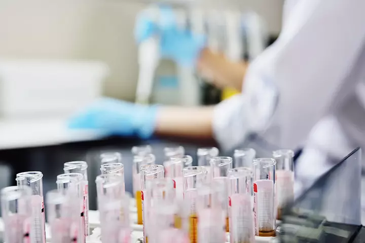 Do We Need To Do Any