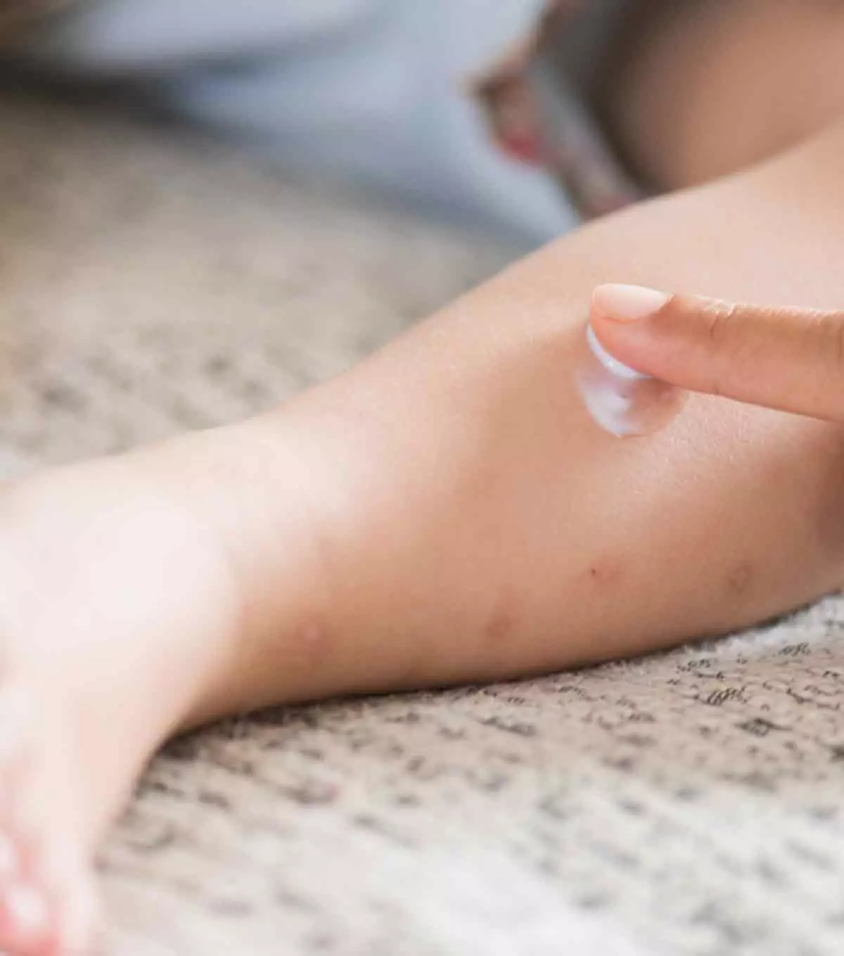 Benefits Of Calamine Lotion For Babies