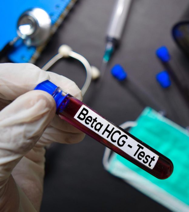 HCG Blood Pregnancy Test How It Works How To Detect Results