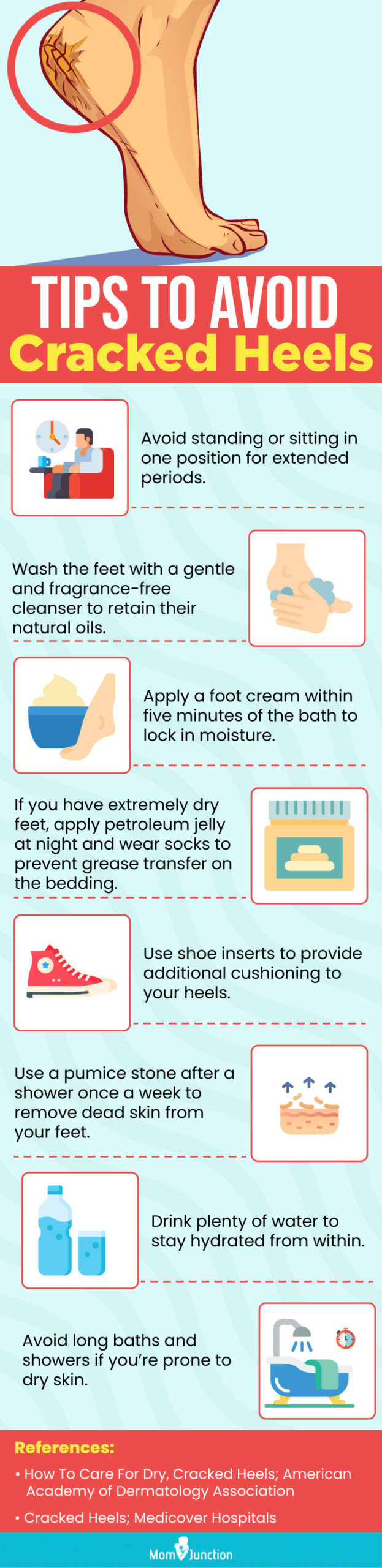 Tips To Avoid Cracked Heels (Infographic)