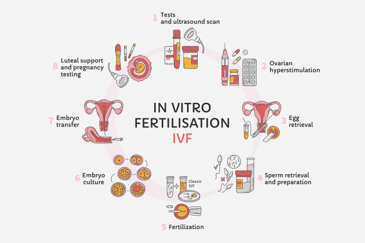 IVF may increase the probability of dual ovulation