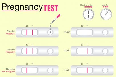 গর্ভধারণের পরীক্ষা: কেন, কিভাবে এবং কখন করতে হবে? | Pregnancy Test: Where, When, How and Why