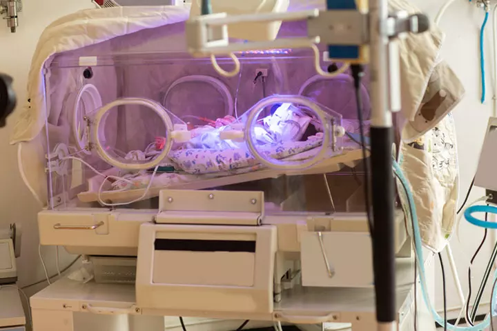 Preterm Babies