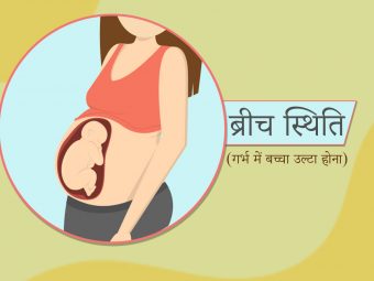 क्या ब्रीच स्थिति (गर्भ में बच्चा उल्टा होना) में सामान्य प्रसव संभव है? | Ulta Bacha (Breech Baby) Normal Delivery