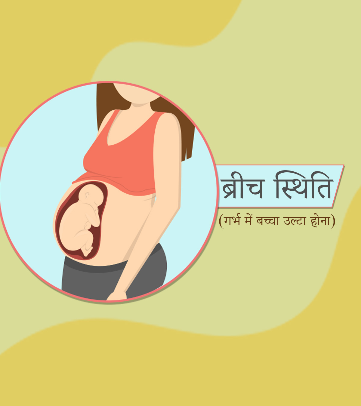 क्या ब्रीच स्थिति (गर्भ में बच्चा उल्टा होना) में सामान्य प्रसव संभव है? | Ulta Bacha (Breech Baby) Normal Delivery