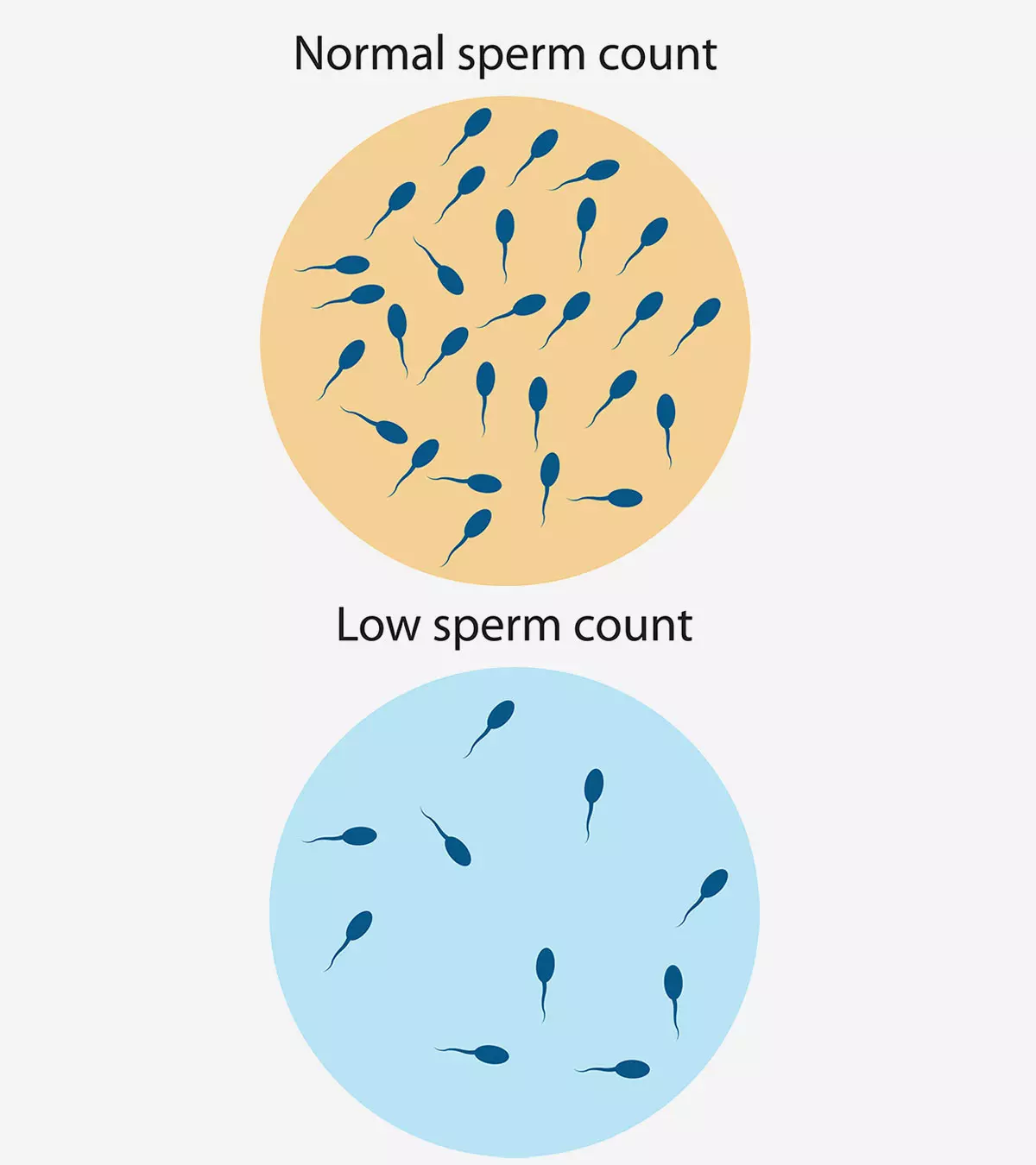 शुक्राणु की कमी (Low Sperm Count) : लक्षण, निदान और इलाज | Sperm Motility In Hindi
