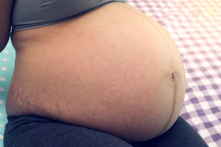 Perks Of Being Pregnant