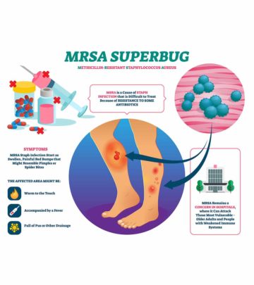 MRSA In Children Causes, Symptoms, Treatment And Risks