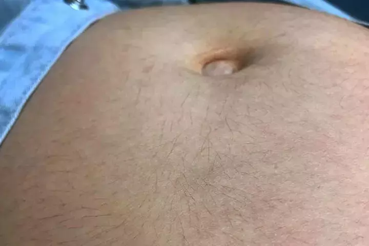 Behold My Hairy Stomach1