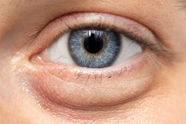 17-causes-of-swollen-eyelids-in-children-and-home-care-tips