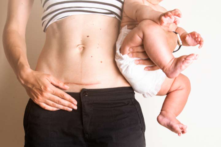 Everything You Need To Know About Postpartum Belly Binding