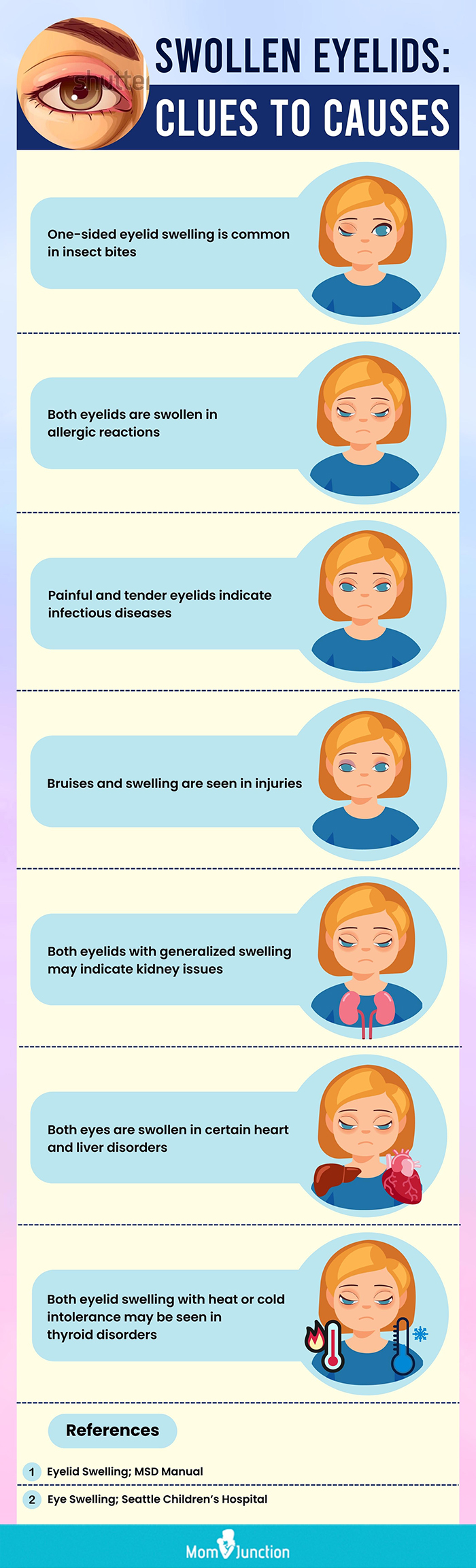 swollen eyelids clues to causes (infographic)