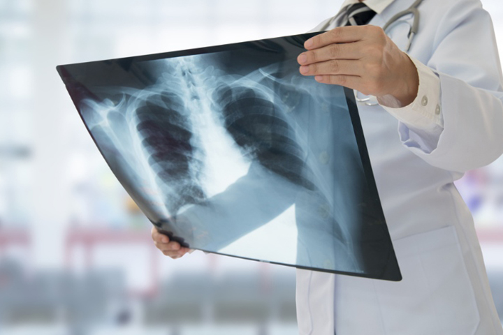 X-ray could help diagnose the problem