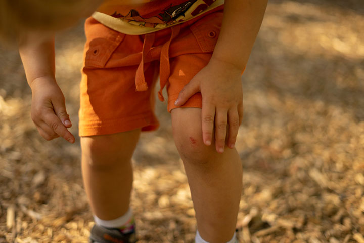 Children may experience knee pain due to overuse 