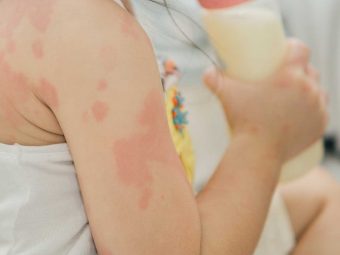 Milk Allergy In Children: Causes, Symptoms, And Treatment