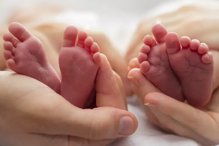 What Are Parasitic Twins And How Do They Develop