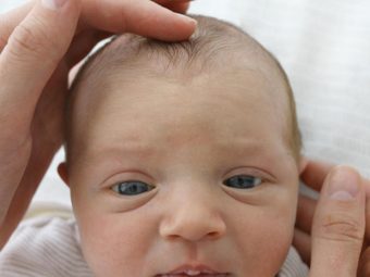 Baby Sunken Fontanelle (Soft Spot): Signs, Causes & Treatment