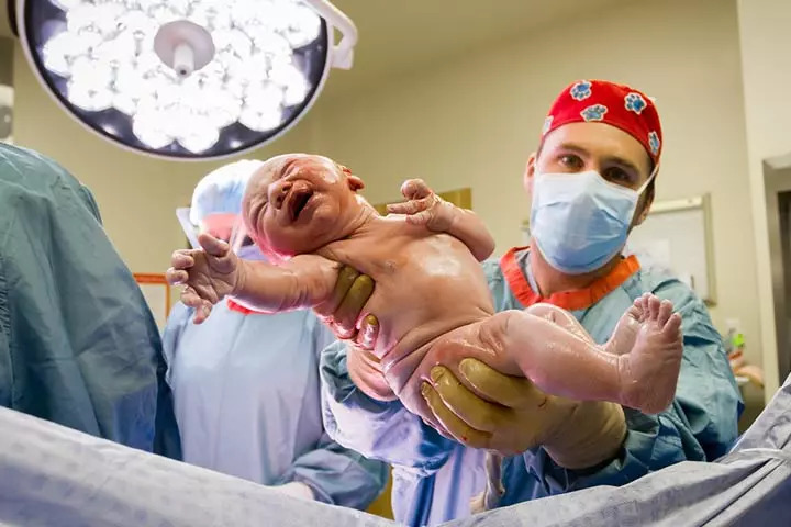 Benefits Of A Gentle C-section