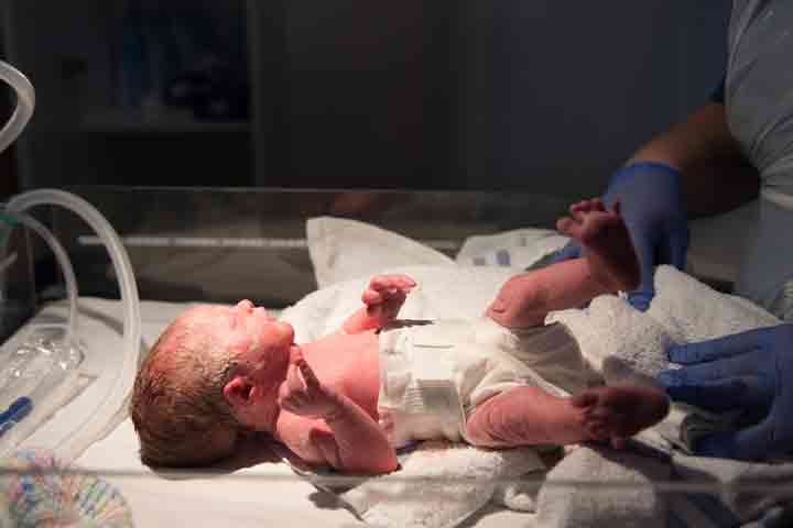The extremely preterm babies require advanced care