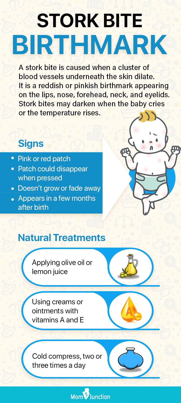treatments for stork bites birthmark [Infographic]