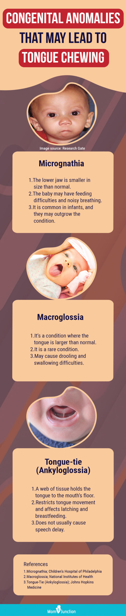 congenital anomalies that may lead to tongue chewing (infographic)