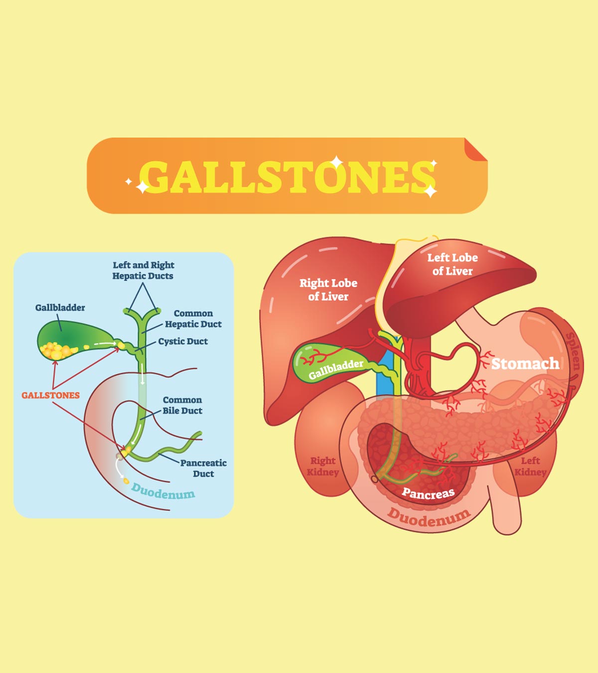 प्रेगनेंसी में पित्ताशय की पथरी होना: कारण, इलाज व जटिलताएं | Gallbladder Stone In Pregnancy In Hindi