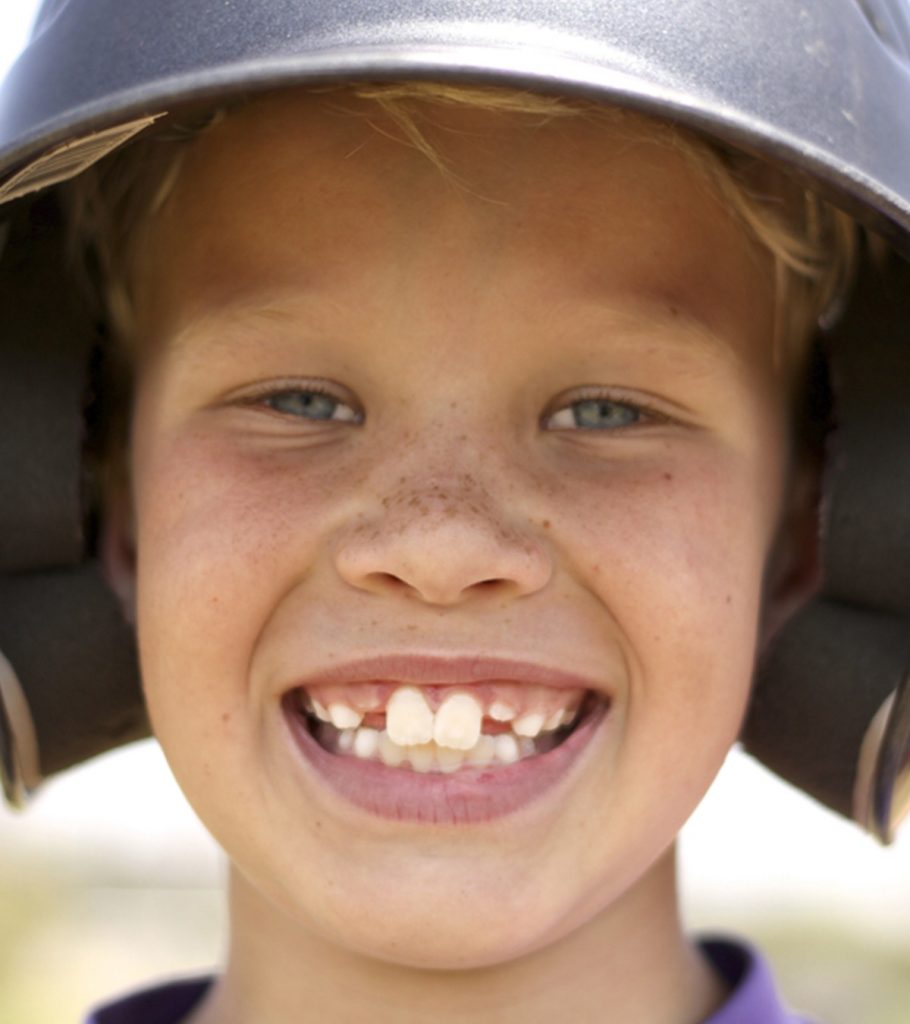 Buck Teeth In Kids: Causes, Health Risks, Pictures & More.