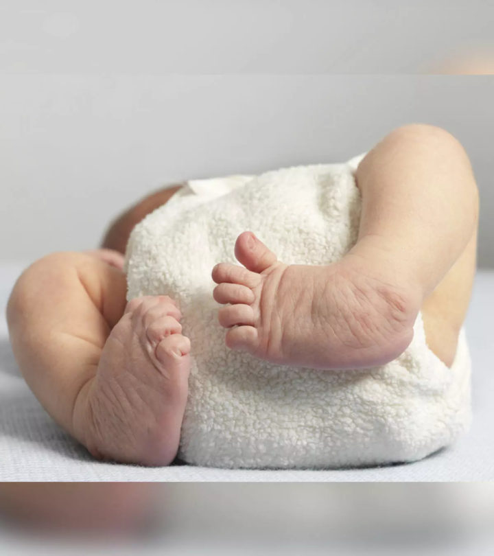 बच च म क लब फ ट प र म ड ह न क समस य इल ज व जट लत ए Clubfoot In Babies In Hindi