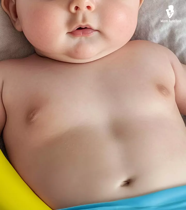 Baby With Lumps In Breast