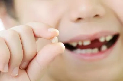 When Do Kids Start Losing Teeth? Age, Order, And Complications
